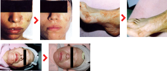 �Â����P�h���A�P���C�h�������قǂ��ꂢ�ɂȂ�}�O�l�e���s�[